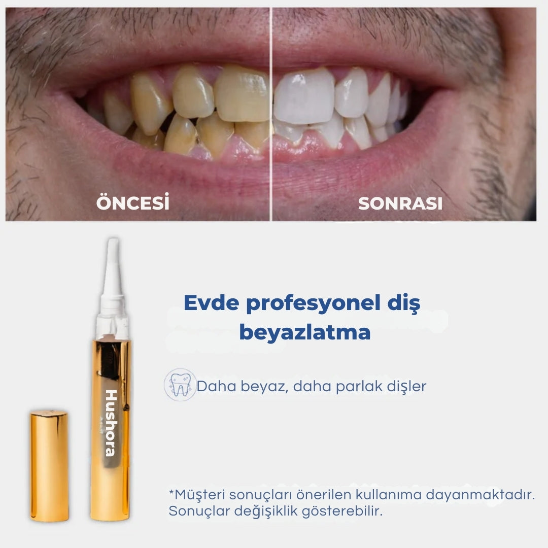 Hushora™ Diş Beyazlatma Kalemi